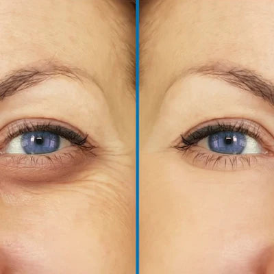 Masajeador Facial Beauty Crystal Ball | Esferas De Cristal Masaje Facial Frío